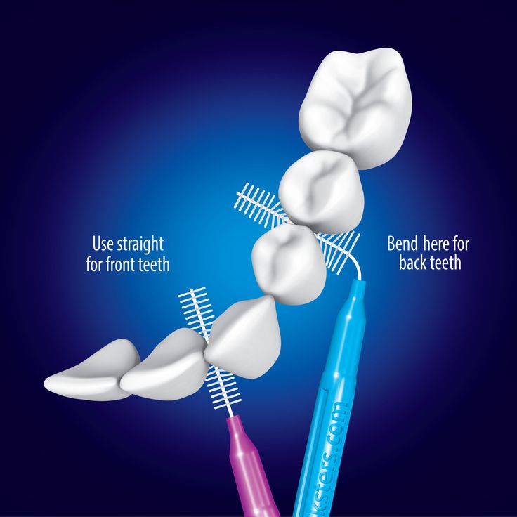 Is it useful to use interdental brush ?