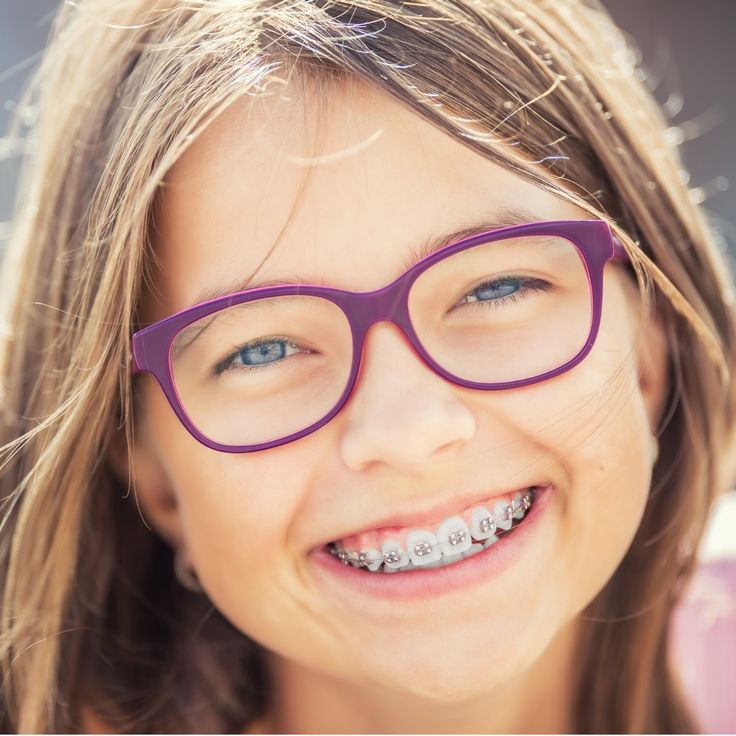 Dental Braces are best for Kids